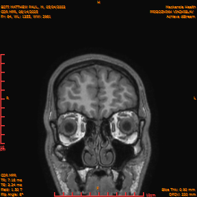 2025-06-14/COR_MPR/0065-IM410.png