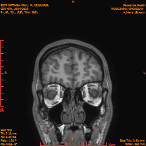 2025-06-14/COR_MPR/0067-IM412.png