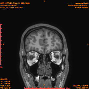 2025-06-14/COR_MPR/0068-IM413.png