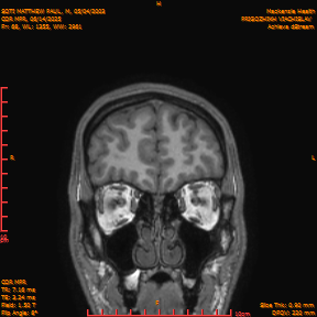 2025-06-14/COR_MPR/0069-IM414.png