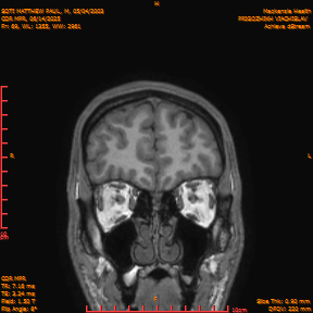 2025-06-14/COR_MPR/0070-IM415.png