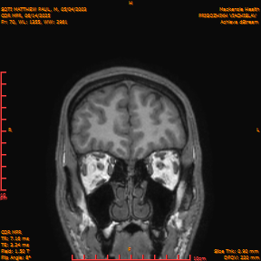 2025-06-14/COR_MPR/0071-IM416.png