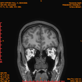 2025-06-14/COR_MPR/0072-IM417.png