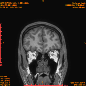 2025-06-14/COR_MPR/0073-IM418.png