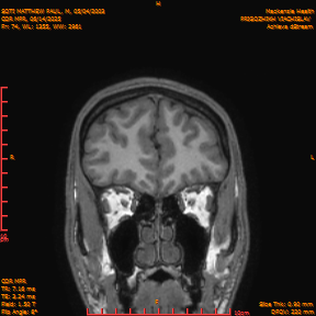 2025-06-14/COR_MPR/0075-IM420.png