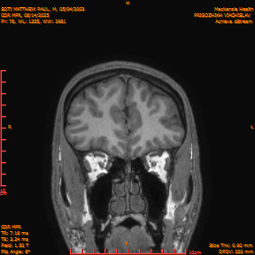 2025-06-14/COR_MPR/0077-IM422.png