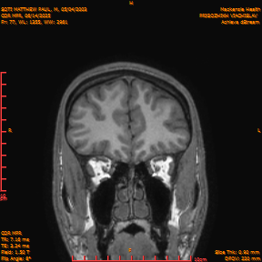 2025-06-14/COR_MPR/0078-IM423.png