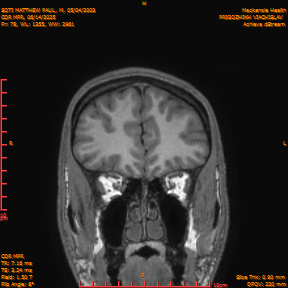 2025-06-14/COR_MPR/0079-IM424.png