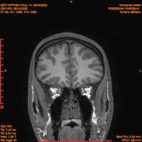 2025-06-14/COR_MPR/0081-IM426.png