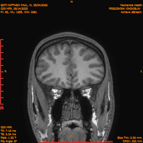 2025-06-14/COR_MPR/0083-IM428.png