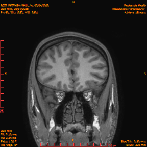 2025-06-14/COR_MPR/0087-IM432.png