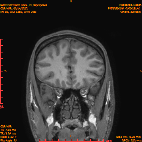 2025-06-14/COR_MPR/0089-IM433.png