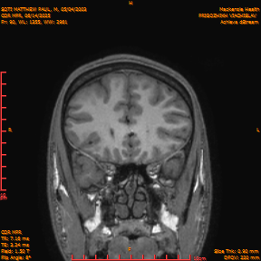 2025-06-14/COR_MPR/0091-IM436.png