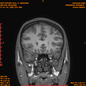 2025-06-14/COR_MPR/0092-IM437.png