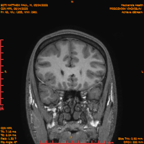 2025-06-14/COR_MPR/0093-IM438.png