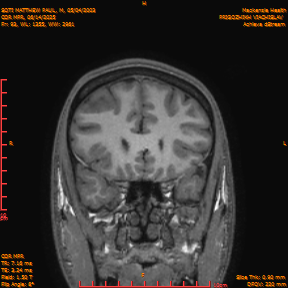 2025-06-14/COR_MPR/0094-IM439.png
