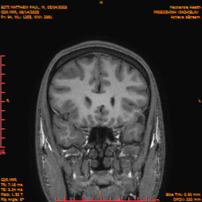 2025-06-14/COR_MPR/0095-IM440.png
