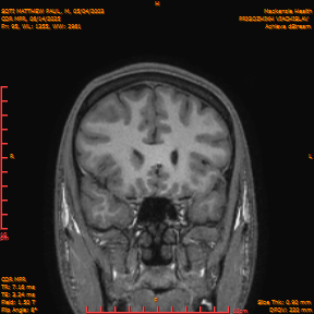 2025-06-14/COR_MPR/0096-IM441.png