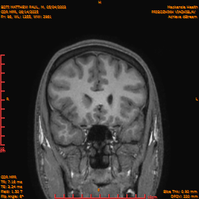 2025-06-14/COR_MPR/0097-IM442.png