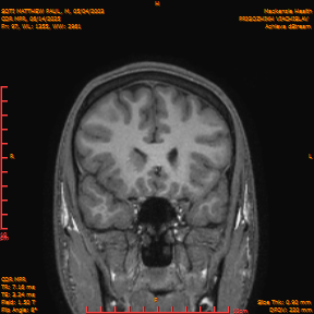 2025-06-14/COR_MPR/0098-IM443.png