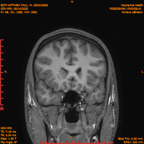 2025-06-14/COR_MPR/0099-IM444.png