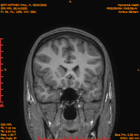 2025-06-14/COR_MPR/0100-IM445.png