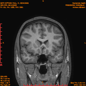 2025-06-14/COR_MPR/0102-IM447.png