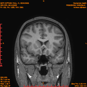2025-06-14/COR_MPR/0103-IM448.png