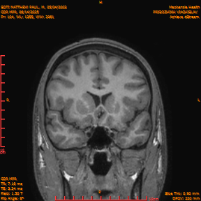 2025-06-14/COR_MPR/0105-IM450.png