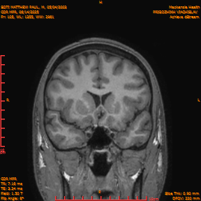 2025-06-14/COR_MPR/0106-IM451.png