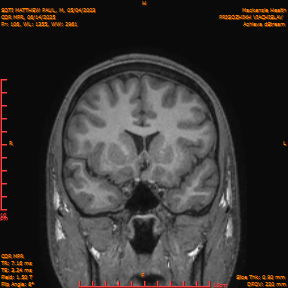 2025-06-14/COR_MPR/0107-IM452.png
