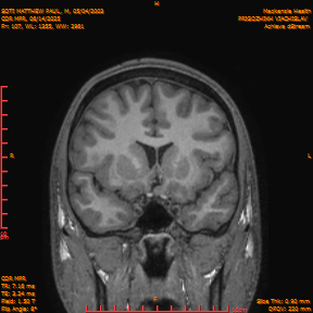 2025-06-14/COR_MPR/0108-IM453.png
