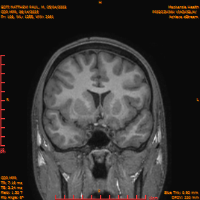2025-06-14/COR_MPR/0109-IM454.png