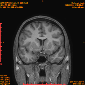 2025-06-14/COR_MPR/0110-IM455.png