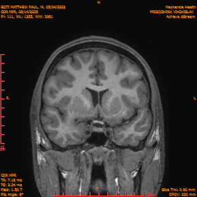 2025-06-14/COR_MPR/0112-IM457.png