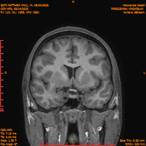 2025-06-14/COR_MPR/0113-IM458.png
