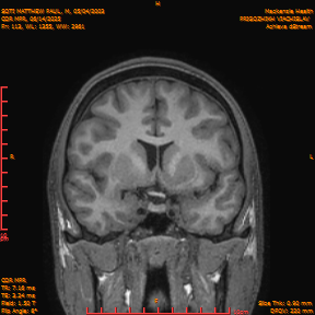 2025-06-14/COR_MPR/0114-IM459.png