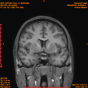 2025-06-14/COR_MPR/0115-IM460.png