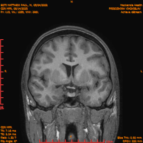2025-06-14/COR_MPR/0116-IM461.png