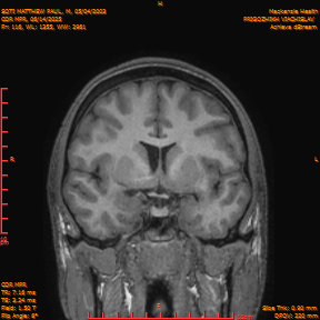 2025-06-14/COR_MPR/0117-IM462.png