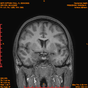 2025-06-14/COR_MPR/0118-IM463.png