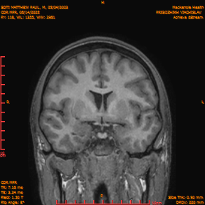 2025-06-14/COR_MPR/0119-IM464.png