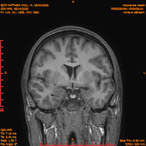 2025-06-14/COR_MPR/0120-IM465.png