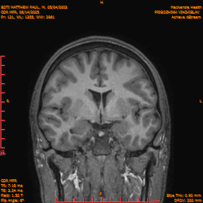 2025-06-14/COR_MPR/0122-IM467.png
