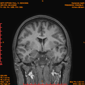 2025-06-14/COR_MPR/0123-IM468.png
