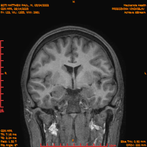 2025-06-14/COR_MPR/0124-IM469.png