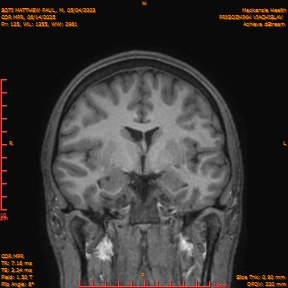 2025-06-14/COR_MPR/0126-IM471.png