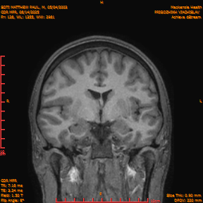 2025-06-14/COR_MPR/0127-IM472.png