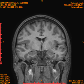 2025-06-14/COR_MPR/0128-IM473.png