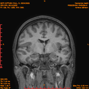 2025-06-14/COR_MPR/0129-IM474.png